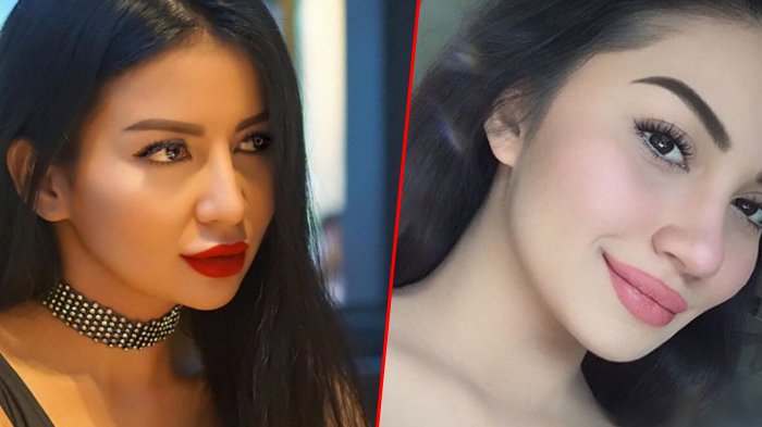 Biar Lebih Seksi, Deretan Artis Ini Disebut-sebut Lakukan Filler Bibir