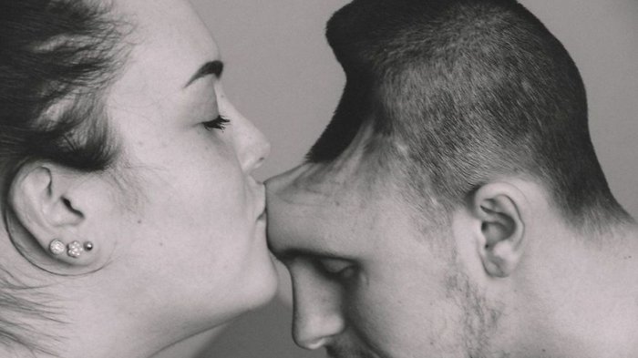 Kisah Haru Mamah Muda Hidup Bersama Suami yang Kehilangan Kepala Bagian Depan