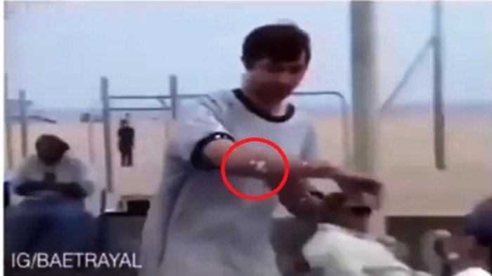 Pengunjung Taman Bingung Ada Bercak Putih di Tubuh, Ternyata Ini Penyebabnya