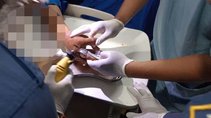 Perkara Cincin Tak Bisa Dilepas, Damkar Bogor Turun Tangan Bantu Pasien Korban Bacok di RS UMMI