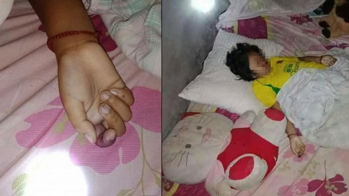 Ini Akibatnya Kalau Kamar Berantakan, Bocah 9 Tahun Tewas Digigit Ular Kobra Saat Tidur