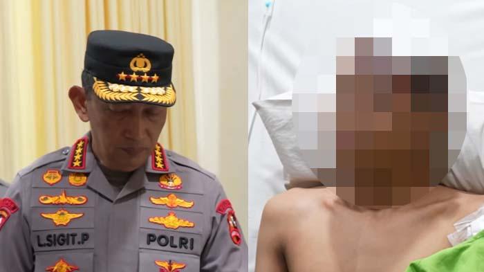 LEDAKAN DI SMAN 72: Raut wajah terduga pelaku (kanan) ledakan di SMAN 72 Jakarta saat dijenguk Kapolri Jenderal Listyo Sigit Prabowo (kiri) pada Sabtu, 8 November 2025 jadi sorotan.