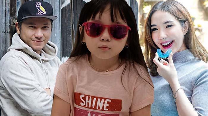 Gisel Mengadu kepada Mantan Perihal Mata Gempi Minus dan Silinder, Gading Marten Beri Reaksi Ini