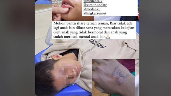 Terungkap 3 Penyebab Siswa MAN Dianiaya 20 Orang, Korban Dikeroyok Gara-gara Selamatkan Nyawa Teman