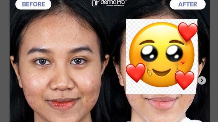 Habiskan Rp 80 Juta Demi Tampil Cantik, Wajah Mayang yang Makin Glowing Disorot, Fuji Komentar Ini