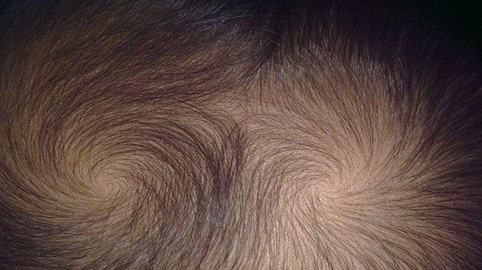 Punya 2 Unyeng-unyeng di Kepala Disebut Anak Nakal, Padahal Ini 4 Fakta Sebenarnya