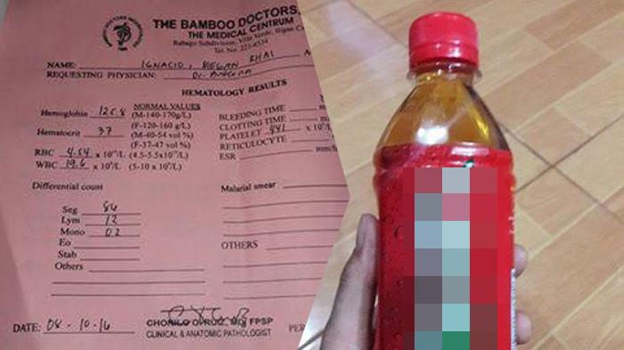 Putri Ibu Ini Sering Konsumsi Minuman Teh Dalam Kemasan, Kondisi Urinenya Kini Mengkhawatirkan