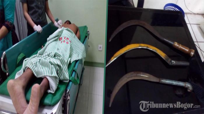 Tawuran Pelajar, 4 Siswa Alami Luka Bacok, Polisi Amankan 3 Celurit