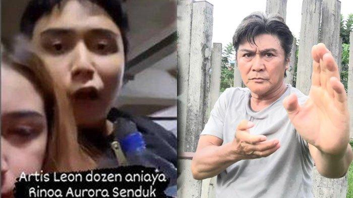 Respon Bijak Willy Dozan Usai Leon Dozan Jadi Tersangka, Tak Ingin Anaknya Dibebaskan Karena Ini