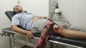 Korban-begal-di-Jalan-Raya-Tlajung-Selasa-2722024.jpg