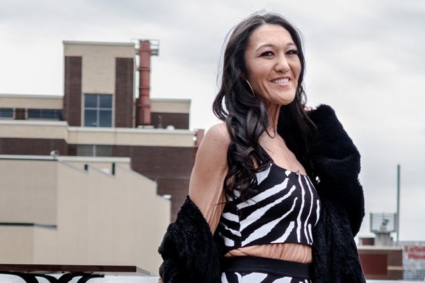 Terjebak Kulit Lansia, Wanita 28 Tahun Ini Tetap Percaya Diri Jalani Dunia Modeling