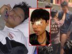 Kebohongan-korban-bully-geng-anak-vincent.jpg
