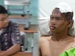 Tatapan-Tajam-Pelaku-Ledakan-SMAN-72-Jakarta-Dengan-Kepala-Terluka.jpg