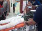 anggota-polres-cianjur-aiptu-erwin-yang-mengalami-luka-bakar.jpg