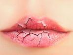 cara-mengobati-bibir-kering.jpg