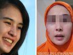 ibu-muda-korban-kdrt-depok.jpg