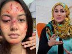 pamer-rias-wajah-babak-belur-aurelie-moeremans-disentil-keras-psikolog-poppy-amalia.jpg