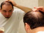 rambut-rontok-dan-kebotakan.jpg