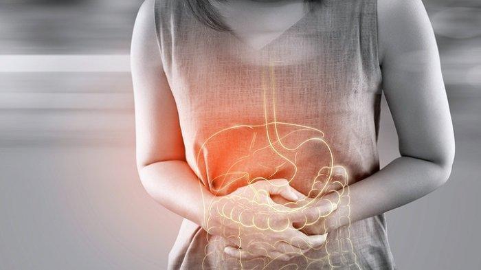 Daftar Makanan yang Bisa Cegah Kanker Usus Besar, Yuk Konsumsi Secara Rutin