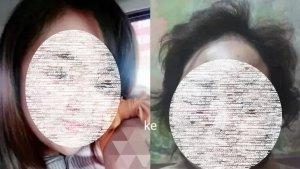 Foto-sebelum-dan-sesudah-korban-DA-mendapat-kekerasan-dalam-rumah-tanggaA.jpg
