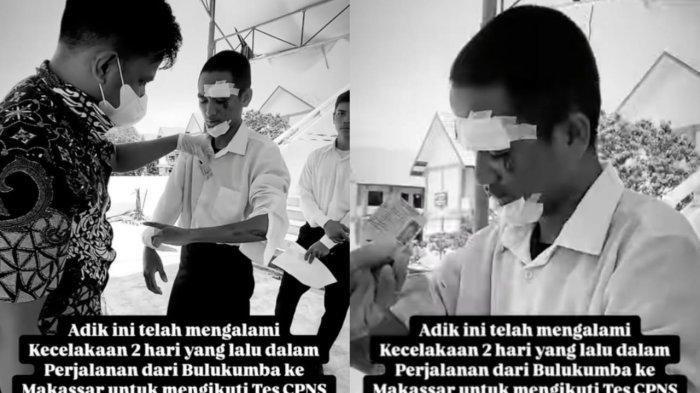 Viral-Peserta-CPNS-Penuh-Luka-di-Wajah-Tetap-Ikut-Tes-SKD-Ternyata-Alami-Kecelakaan.jpg