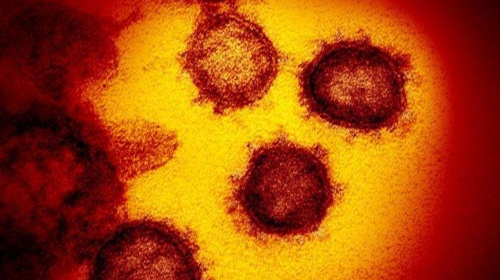 gambar-mikroskop-elektron-transmisi-menunjukkan-virus-corona.jpg