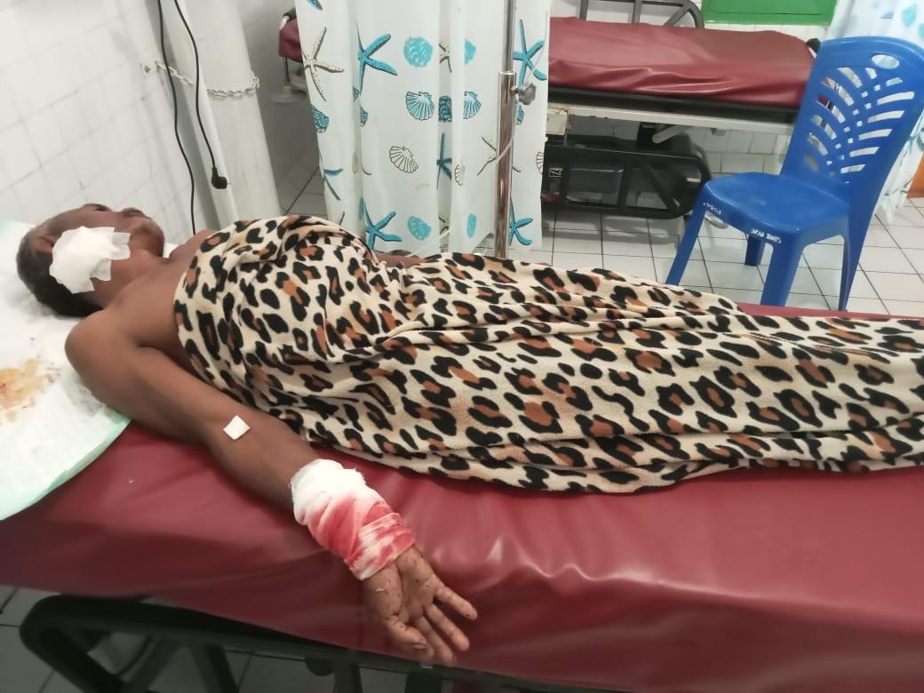 Ibu Rumah Tangga di NTT Bacok Suaminya hingga Sekarat, Anak Dengar Teriakan Sang Ayah