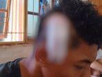 KORBAN-RG-18-pelajar-SMKN-1-Komodo-yang-menjadi-korban-pembacokan.jpg