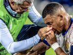 mbappe-hidung.jpg