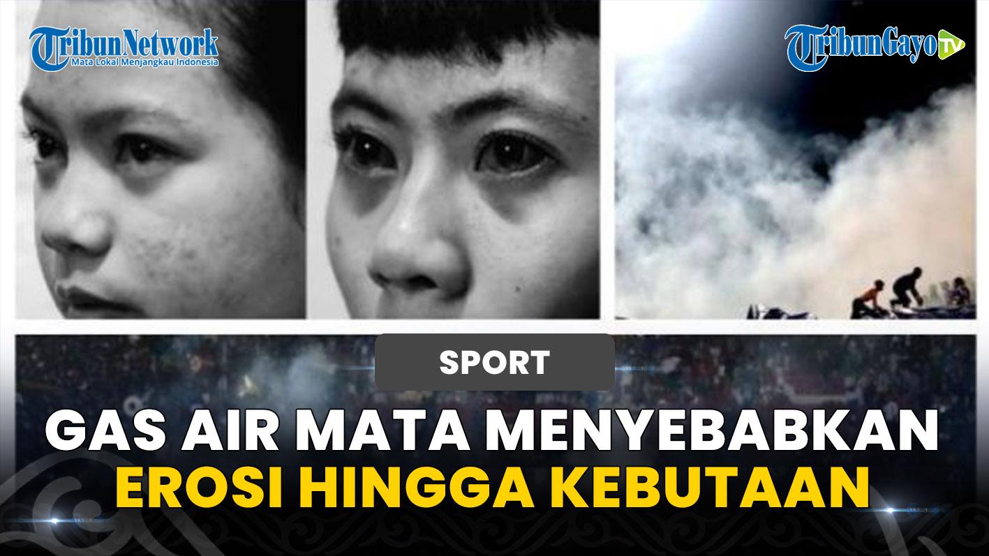 Gas-Air-Mata-Menyebabkan-Erosi-Hingga-Kebutaan-Begini-Tanggapan-Dokter.jpg