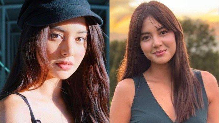 Aurelie Moeremans kecelakaan padahal baru menikah, kondisinya disorot.