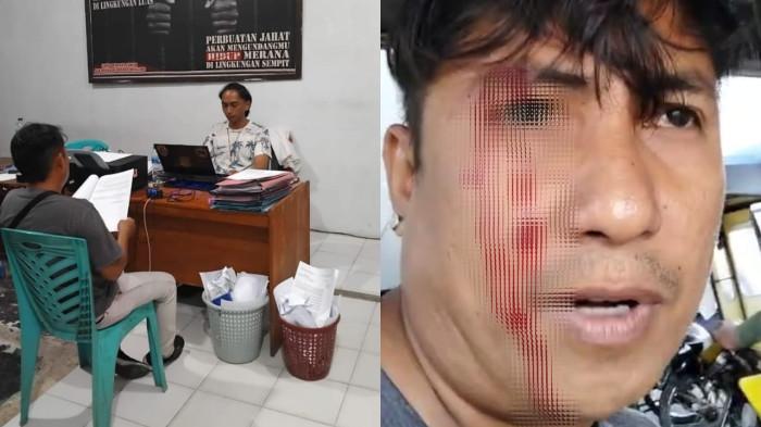 KASUS PENGANIAYAAN -- Kolase foto Fajri Wangkanusa saat melapor ke Polres Boalemo. Fajri dianiaya oleh oknum debt collector.