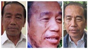 Kondisi-Kesehatan-Joko-Widodo-cvmh.jpg