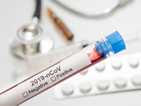 040222-Tes-Covid.jpg