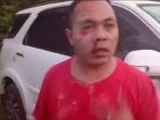 Video-korban-penganiayaan-oleh-WNA-Inggris-di-Uluwatu-Pecatu-Bali.jpg