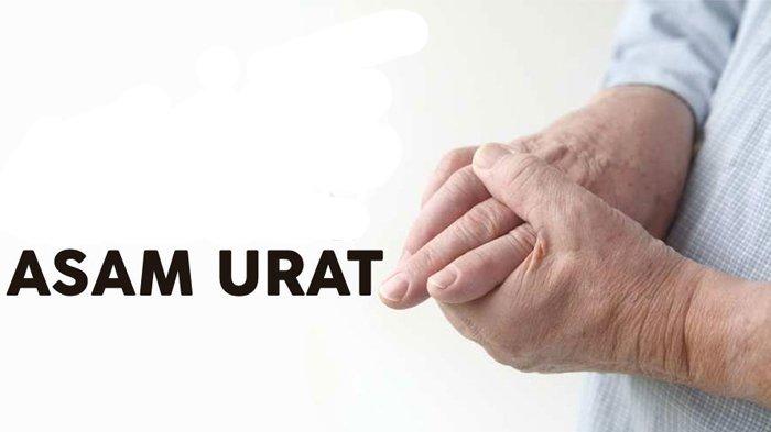 Antara Laki-laki dan Perempuan, Mana yang Paling Banyak Mengalami Asam Urat Tinggi?