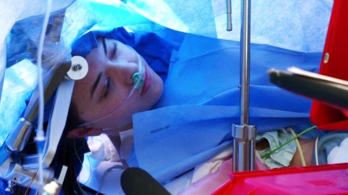 Kenapa Metode Awake Brain Surgery Dipilih? Simak Pemaparan Dokter Spesialis Bedah Saraf