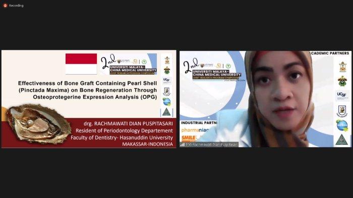 Mahasiswa Spesialis FKG Unhas Jadi Pembicara di Symposium Internasional