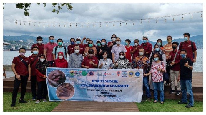 FKG Unhas Gelar Operasi Gratis Celah Bibir dan Lelangit di Kota Ambon