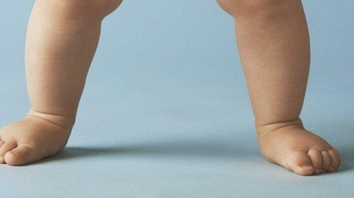 dr. Faisal Mi'raj Sebut Flat Feet Berkepanjangan pada Anak Perlu Diwaspadai