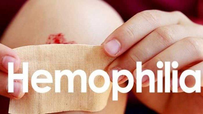 Pahami Kondisi Hemofilia, Kelainan Pendarahan Langka yang Sebabkan Darah Sulit Berhenti saat Luka