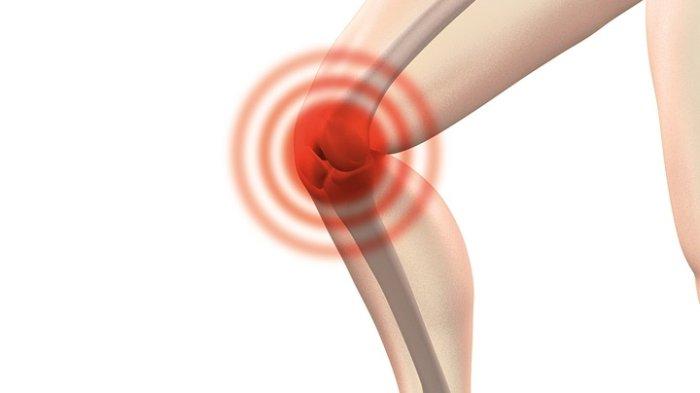 Umumnya Osteoarthritis Terjadi Pada Sendi yang Menyangga Berat Badan, Ini Olahraga yang Tepat