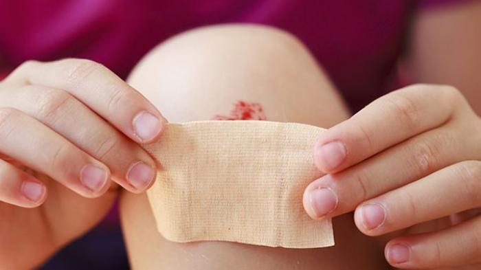 Hemofilia, Kelainan Pembekuan Darah yang Disebabkan Gen Resesif pada Kromosom X
