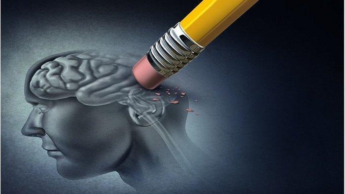 Gaya Hidup Pemicu Penyakit Stroke, Ini Penjelasan Dokter