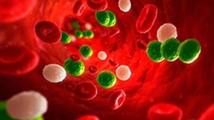 Ketahui Gejala yang Muncul pada Penderita Sepsis, dr. Mustopa, Sp.PD: Tergantung Tempat Infeksi
