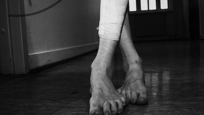 Apakah Penderita Self Harm Sadar Jika Tindakannya Melukai Diri Sendiri? Psikolog Menanggapi