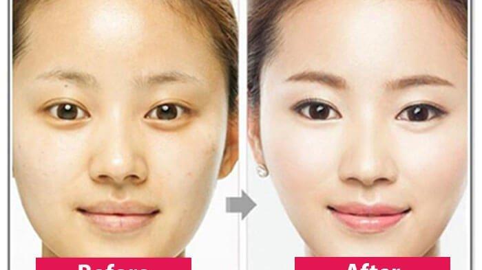 Dokter Kecantikan Jelaskan Upaya-upaya untuk Mendapatkan Wajah V-Shape Tanpa Operasi