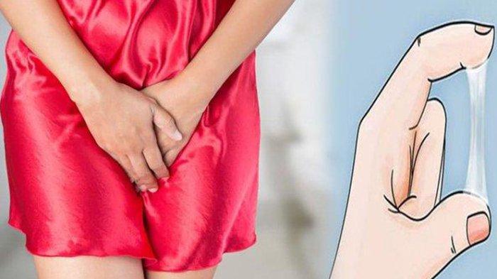 Apa Penyebab Keputihan yang Tergolong Tidak Normal? Ini Kata dr. Lusiyanti Sp.KK