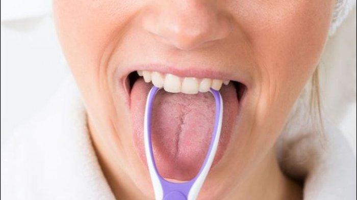 Dokter Gigi Jelaskan Cara Membersihkan Lidah, Ada Dua Cara yaitu Mekanik dan Kimiawi