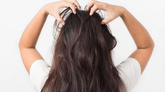 Tinea Capitis Disebabkan oleh Jamur, Picu Munculnya Bercak Gatal di Kulit Kepala